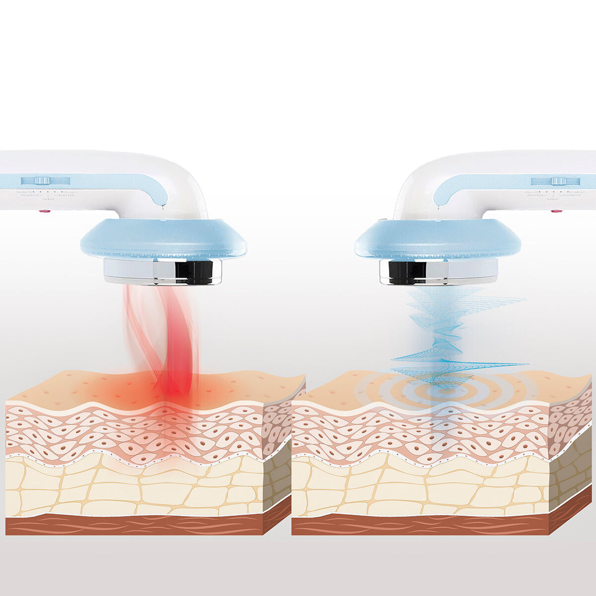 Masseur à cavitation par ultrasons avec infrarouge et électrostimulation CellyMax InnovaGoods